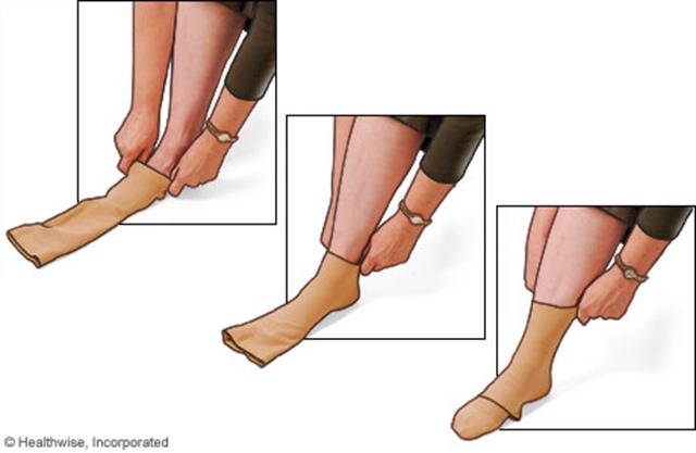 putting on compression stockings healthwise